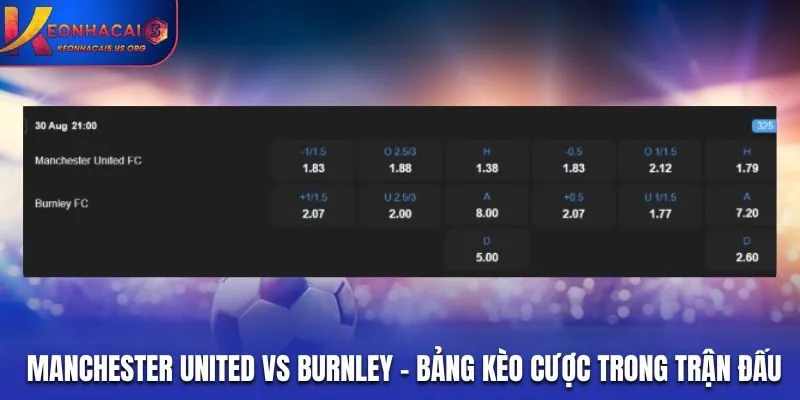 Bảng tỷ lệ cược trận Manchester United vs Burnley